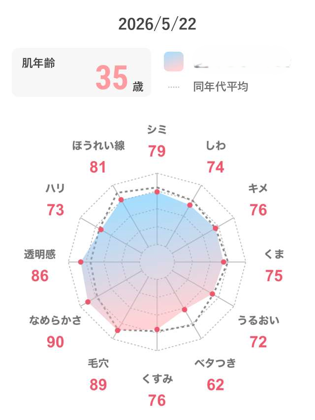 マナラ使用後の肌診断レーダーチャート。肌年齢35歳、毛穴89点、なめらかさ90点の結果