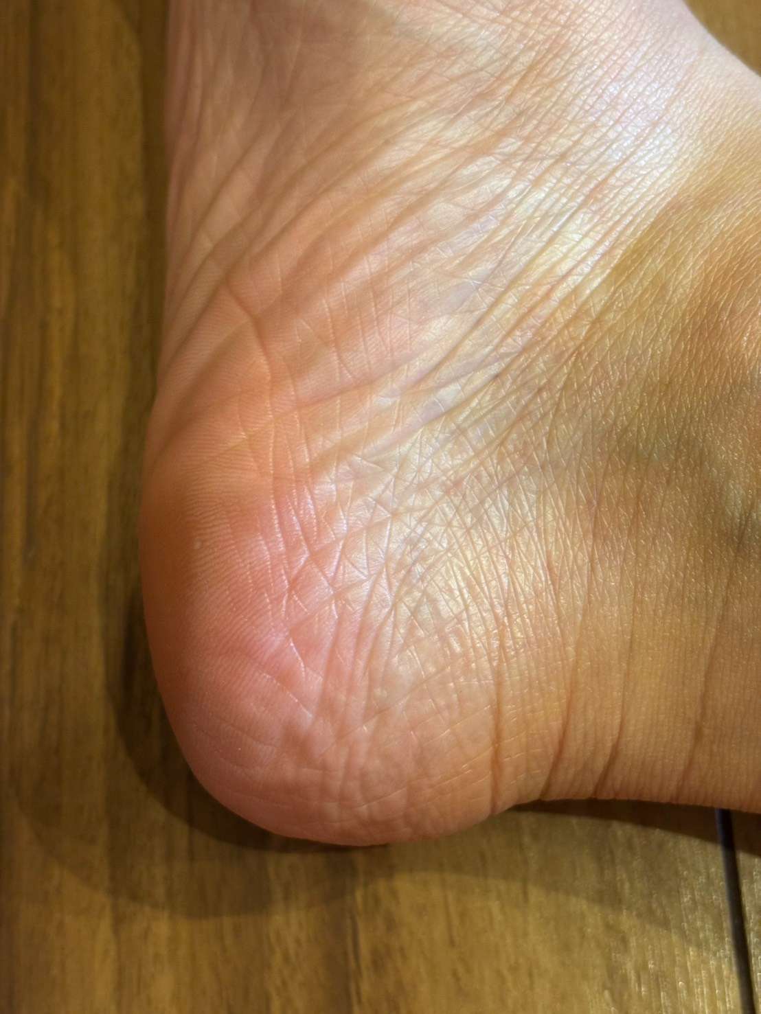 ママバターを塗布してしっとりツヤの出たかかとの写真