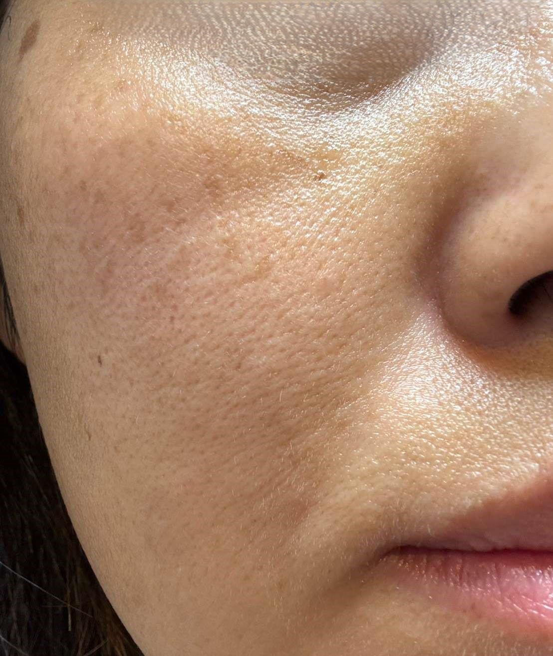 マナラ使用後の右頬の様子。みずみずしいツヤがあり、肌がふっくらして毛穴が目立たなくなっている状態