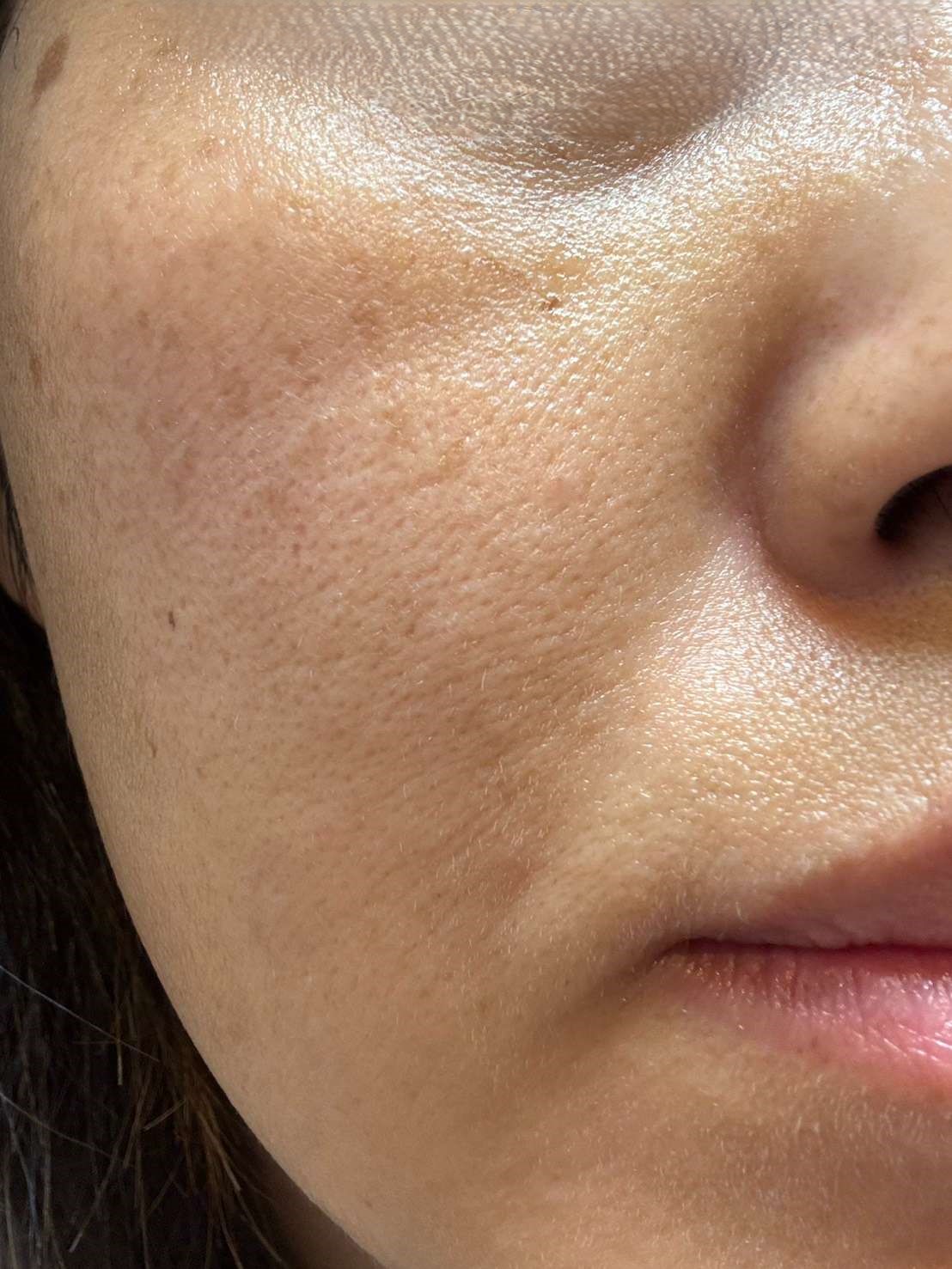 マナラ使用後のハリ感写真（斜め右）。肌のキメが整っている
