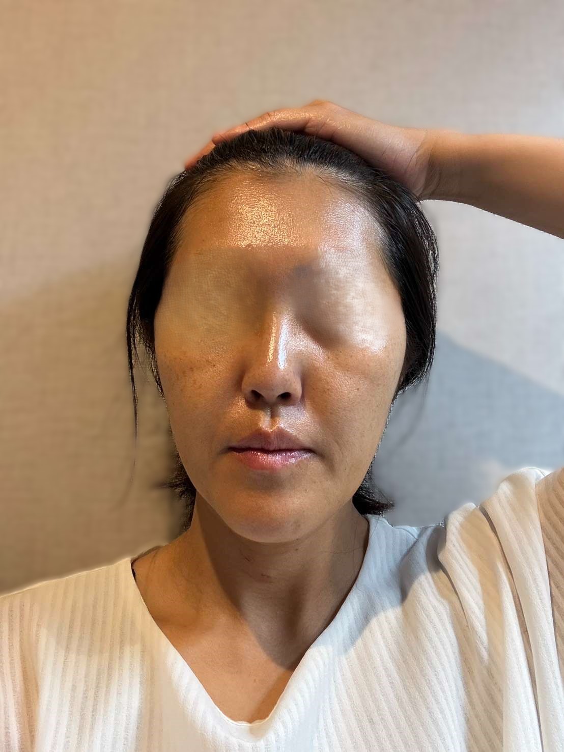 拭き取り洗顔を終えた直後のまっさらな肌状態