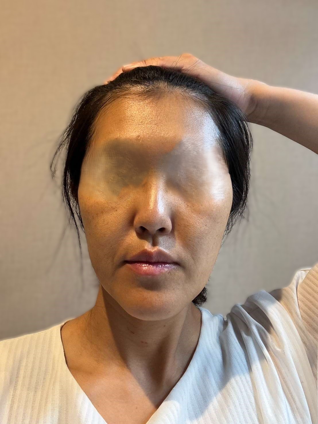 水洗いのみでトイロを重ねた翌朝の肌状態